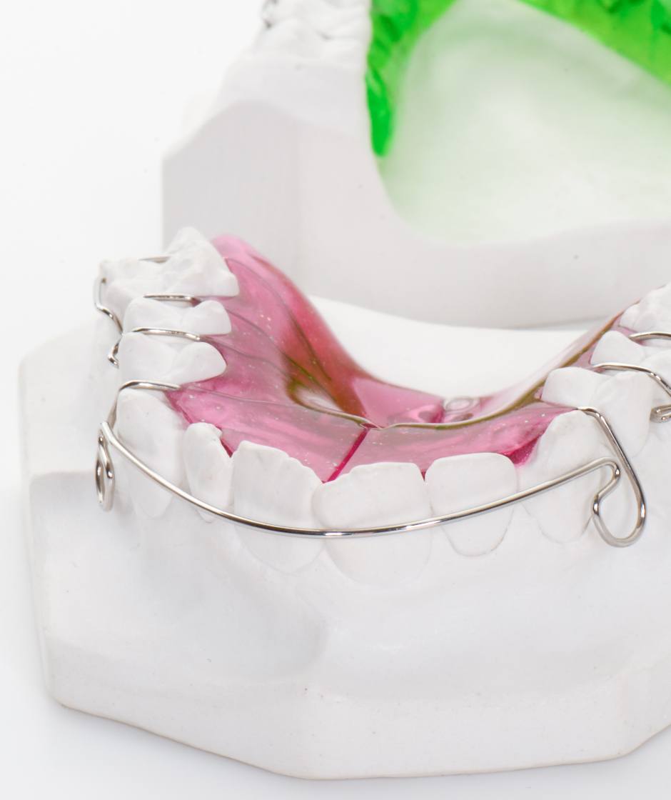 Herausnehmbare Zahnspange an einem Gipsmodell.