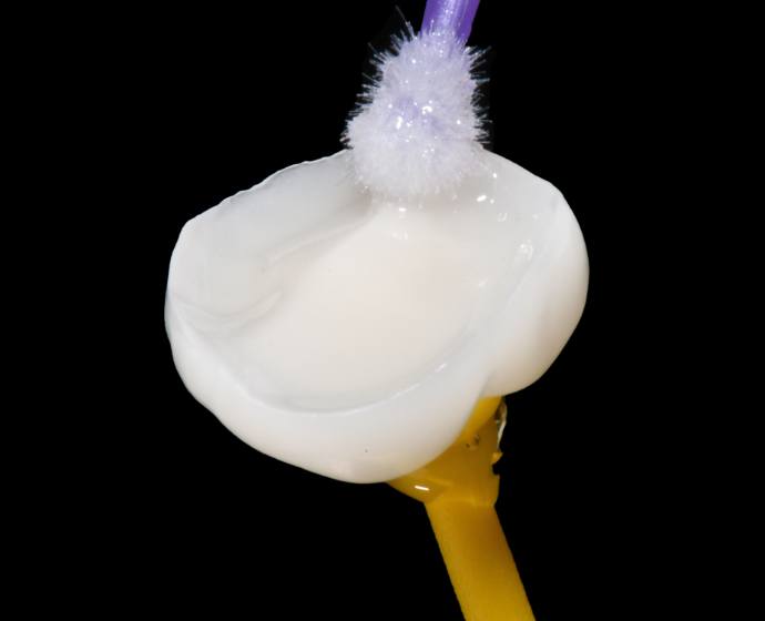 Ansicht eines Onlays aus Keramik von unten. Es wird Bonding aufgetragen.