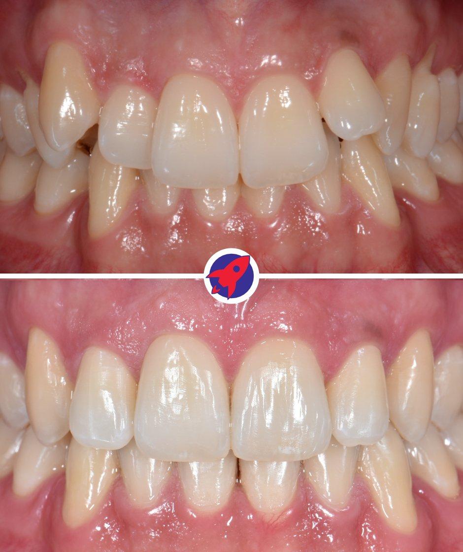 <p>Transformation of a smile</p>