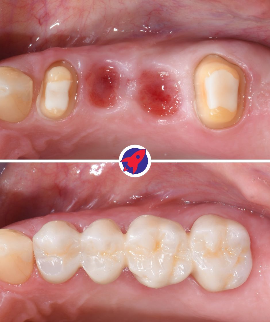 <p class="p1"><span class="s1">Digital Precision</span></p>