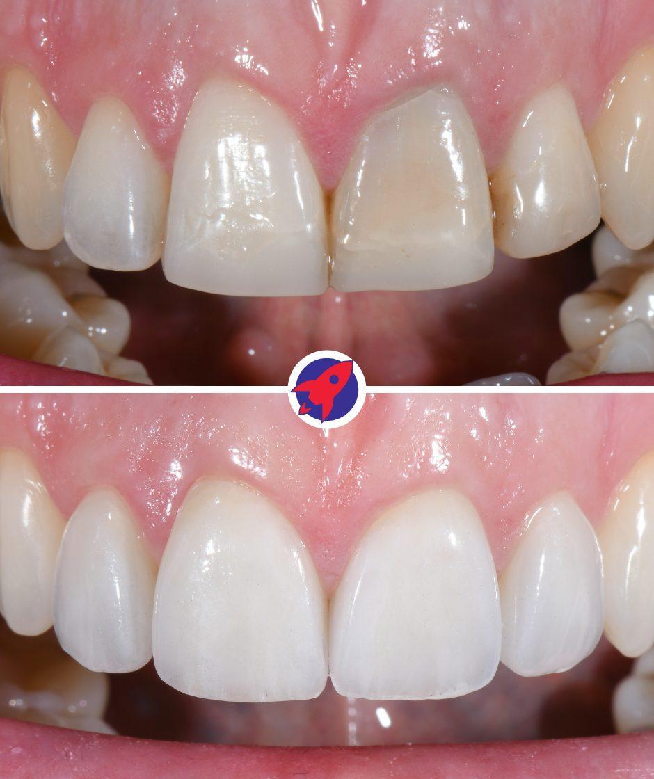 <p>Safety from recurrences</p>