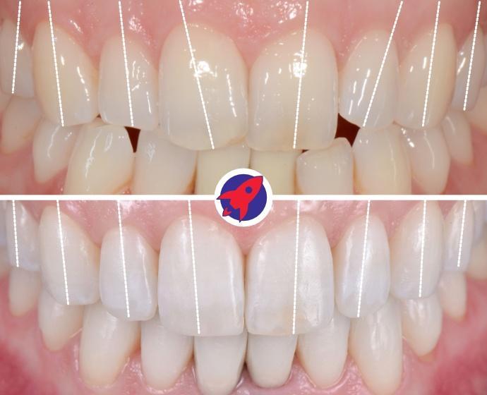 <p>The basis of a healthy smile</p>