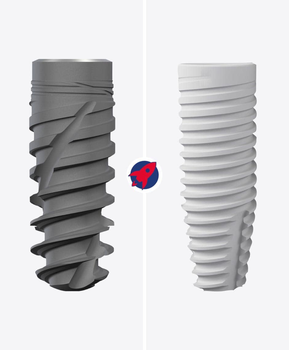 Keramikimplantat und Titanimplantat