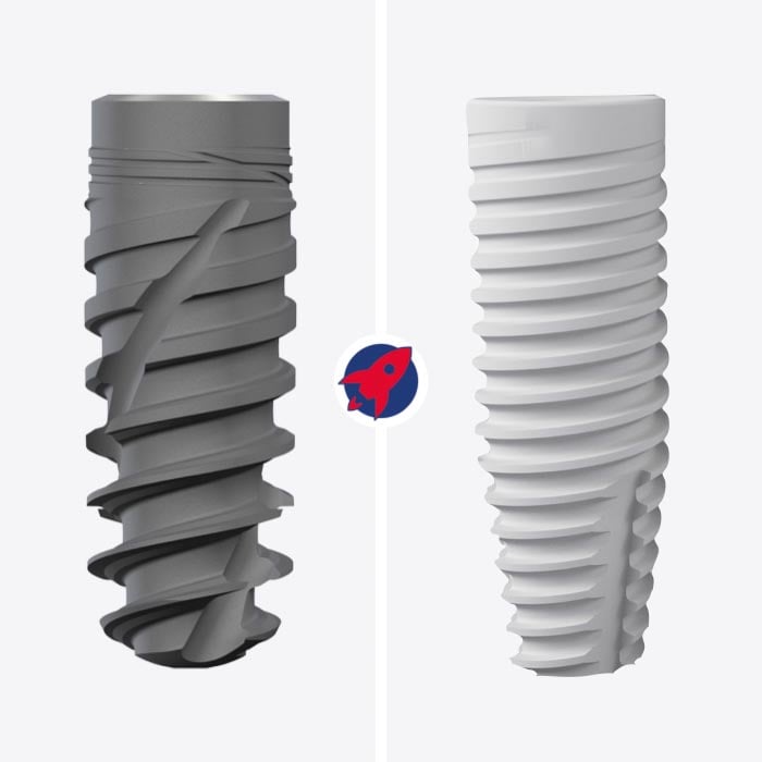 Keramikimplantat und Titanimplantat