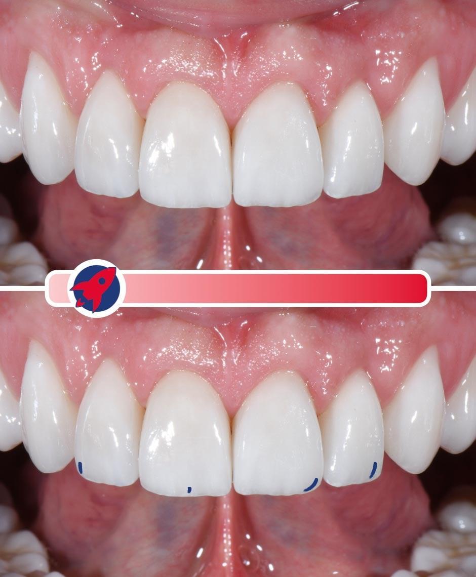 <p>A smile with minimal characterization</p>
