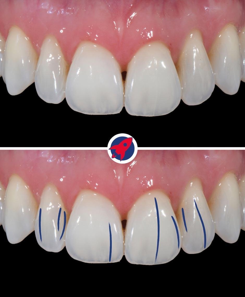 <p>Characteristic lines</p>