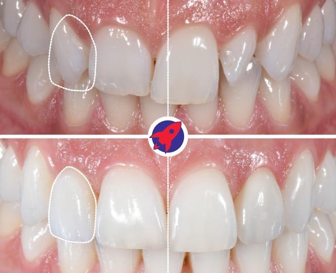 <p>Balance in the smile</p>