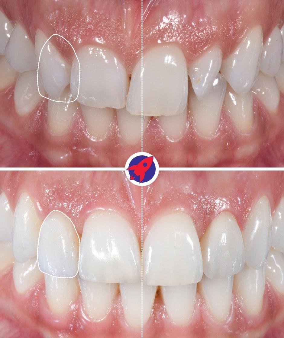 <p>Balance in the smile</p>