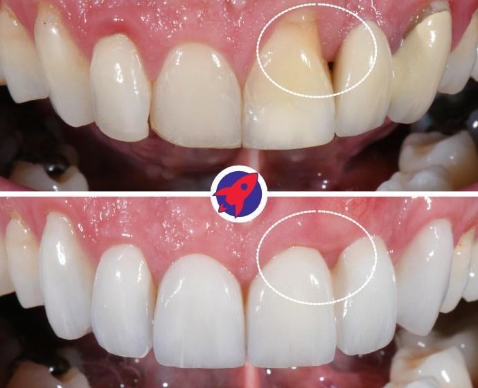 <p>Healthy gums, beautiful smile</p>