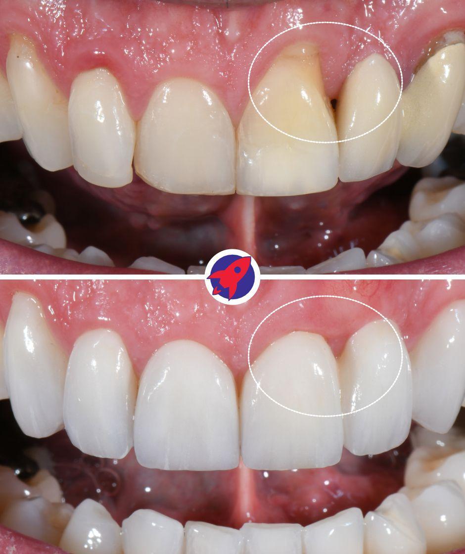 <p>Healthy gums, beautiful smile</p>