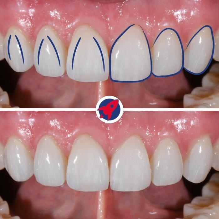 <p>Aesthetics in detail</p>