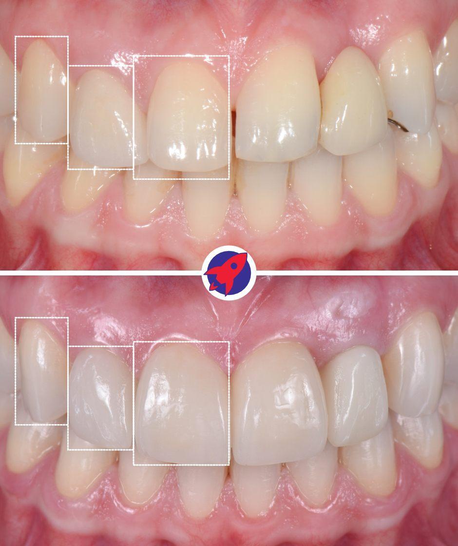 <p>Designing the perfect smile</p>