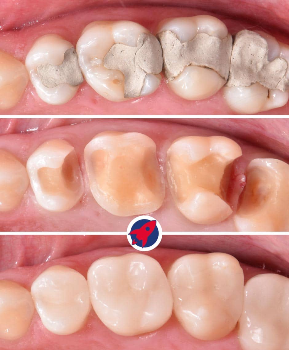 <p class="p1"><span class="s1">Scan • CAD • Mill • Place</span></p>