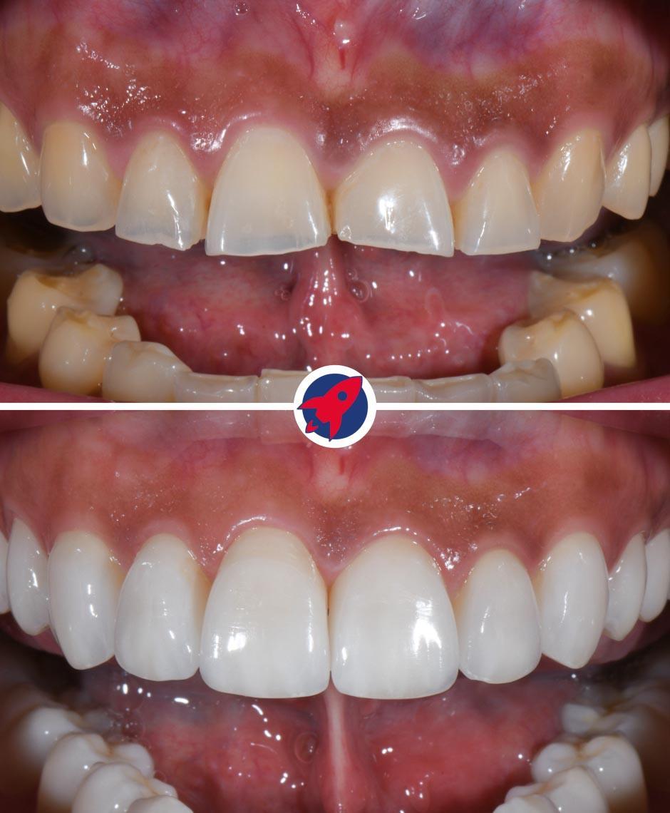 <p class="p1">Minimally invasive techniques for function and aesthetics</p>