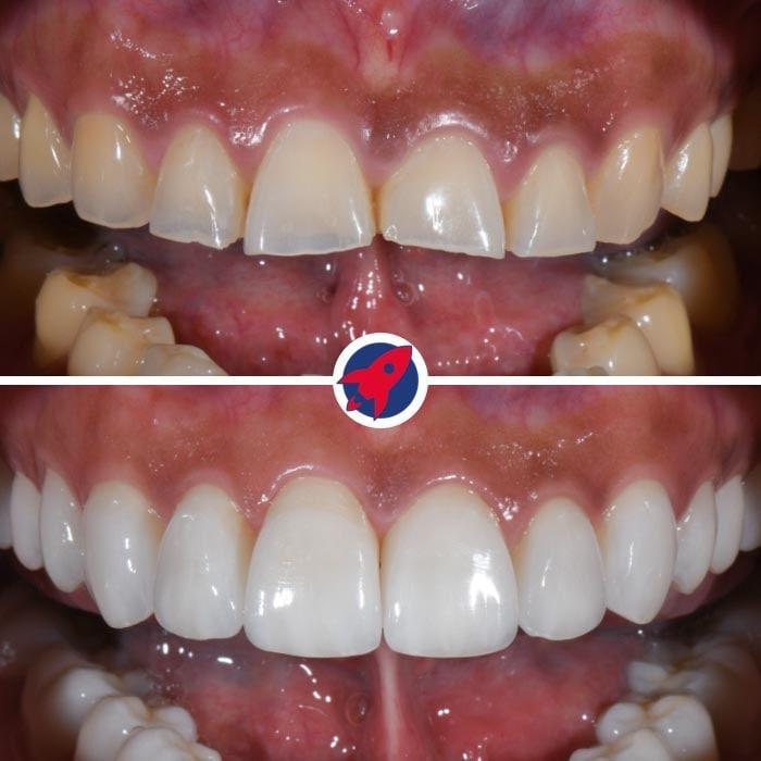 <p class="p1">Minimally invasive techniques for function and aesthetics</p>