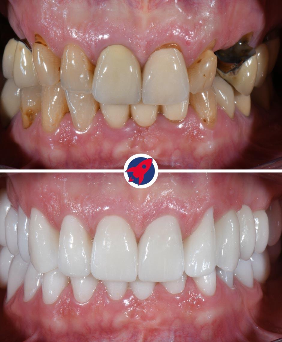 <p class="p1">Functional stability and aesthetic integration</p>