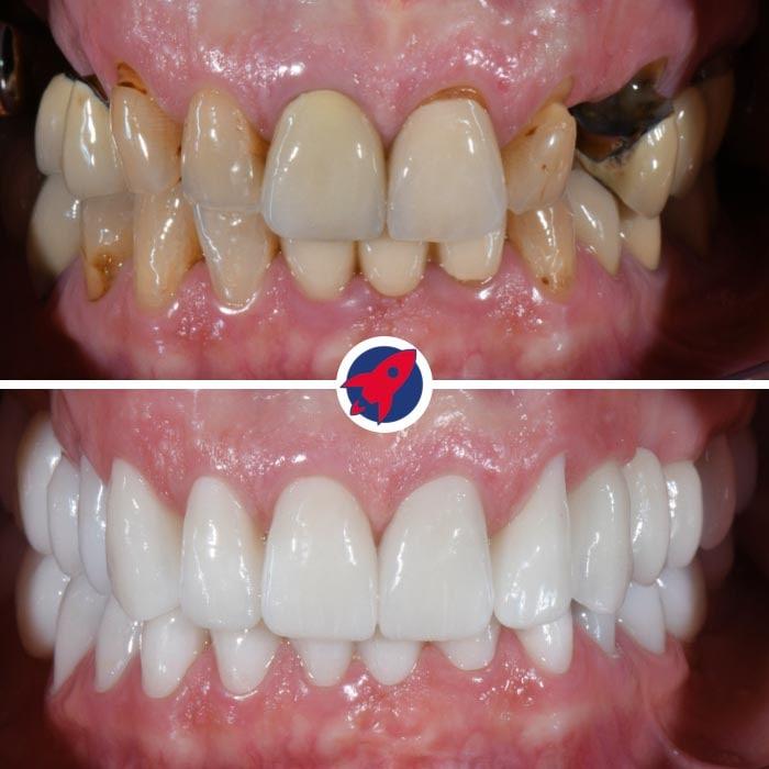 <p class="p1">Functional stability and aesthetic integration</p>