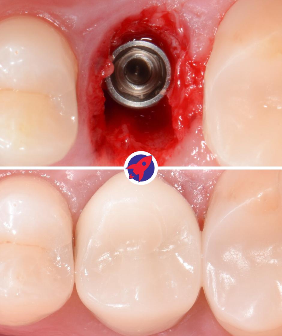 <p class="p1"><span class="s1">Decision by indication</span></p>