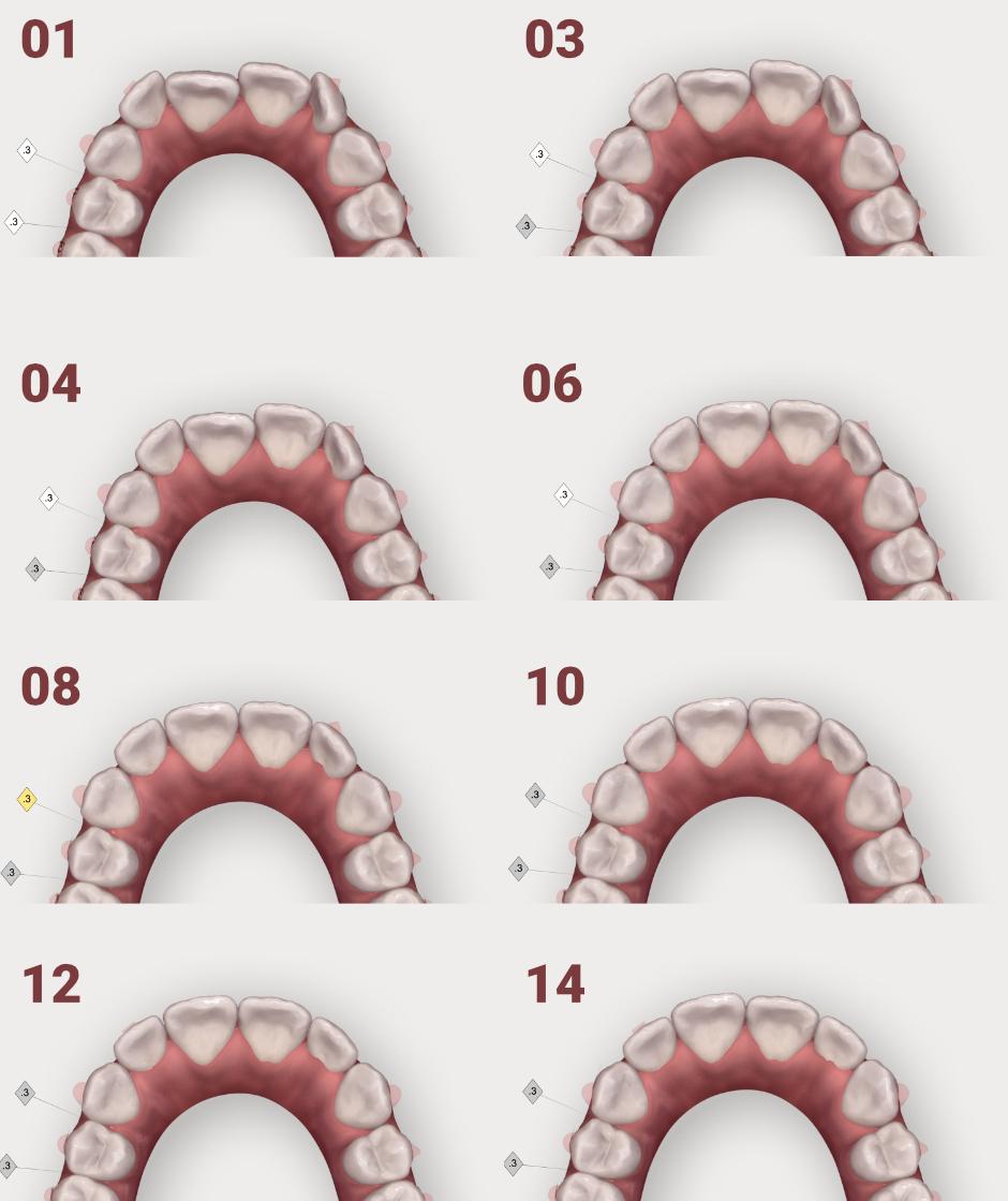 <p>From 3 months to 18 months: depending on the case</p>