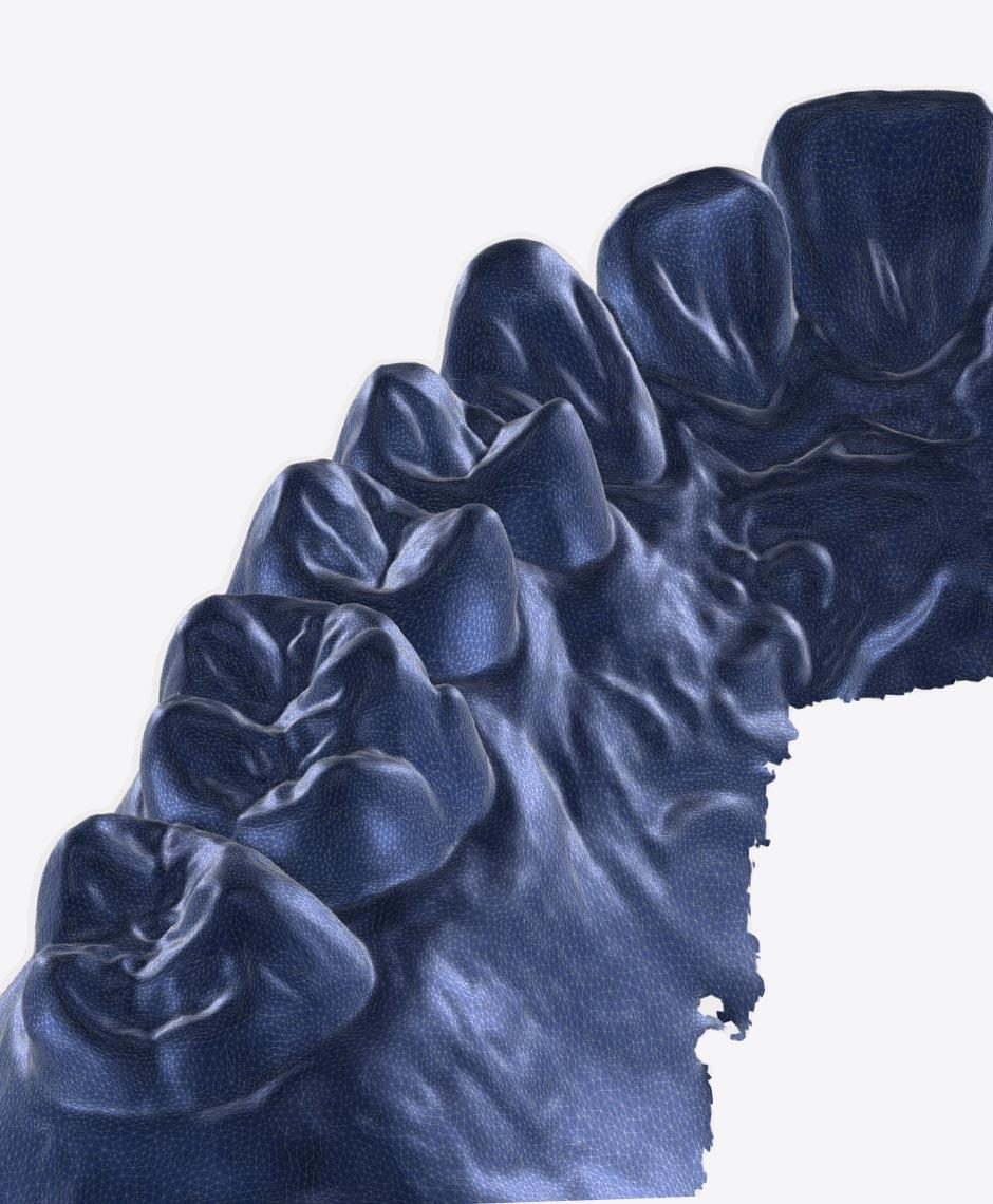 3D Zahnscan, erstellt mit unserem Intraoralscanner in unserer Praxis in Jestetten.