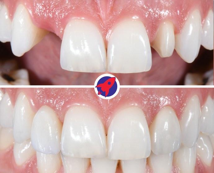 <p class="p1"><span class="s1">Minimally Invasive</span></p>