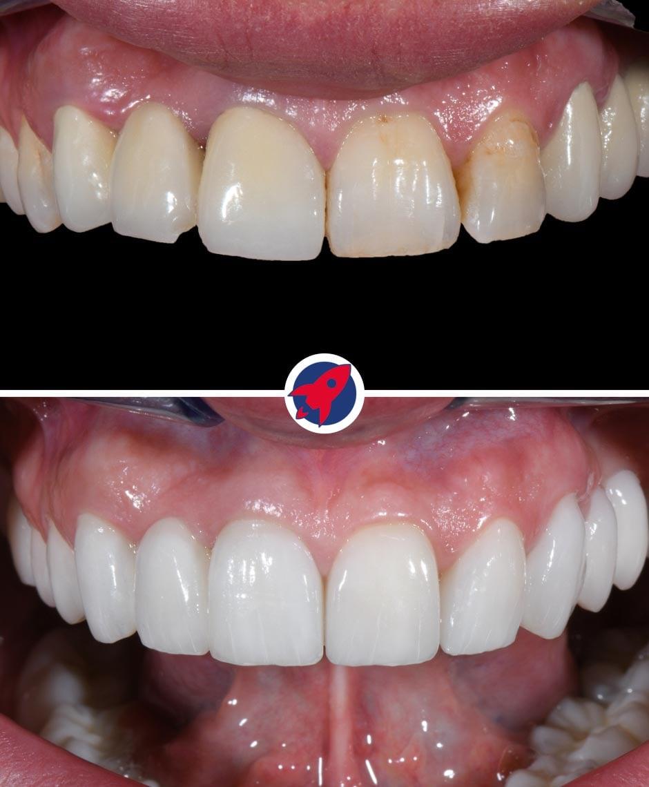 <p class="p1"><span class="s1">Why did it fail?</span></p>