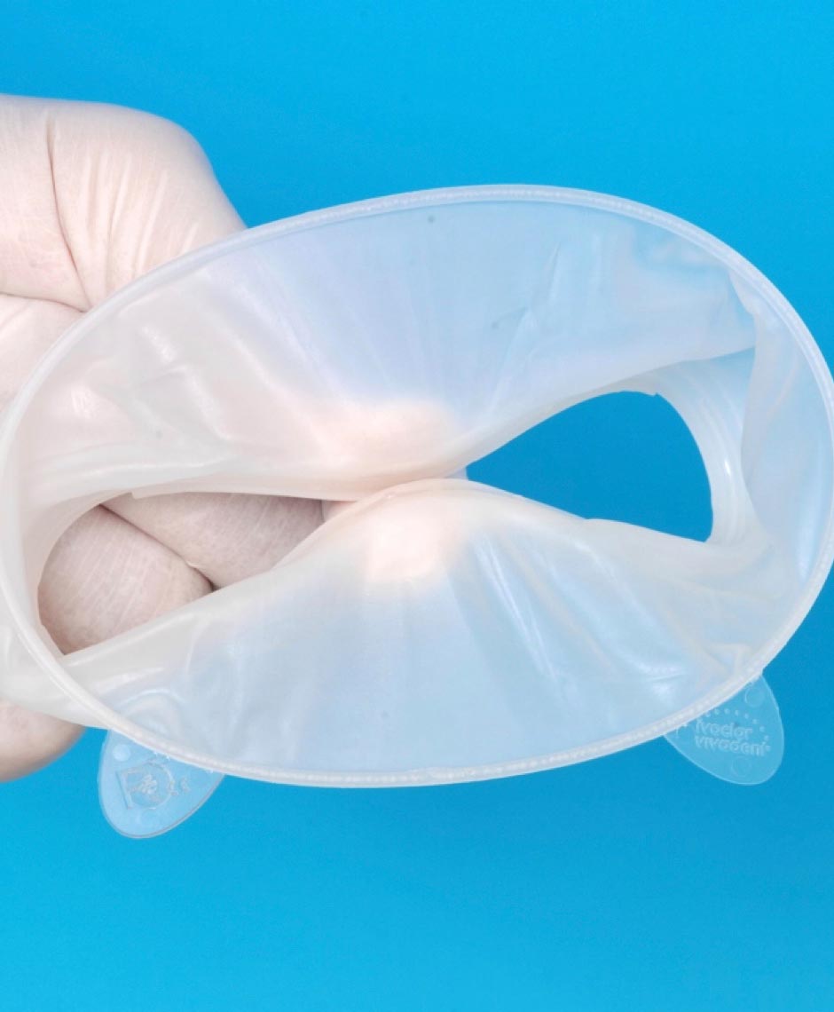 OptraGate Produktansicht – elastischer Lippen- und Wangenhalter