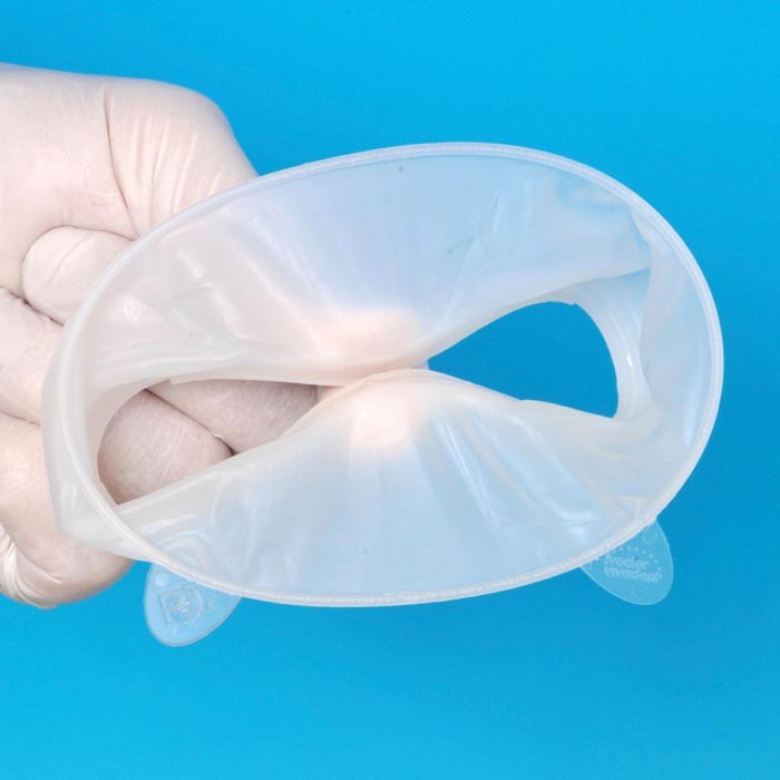 OptraGate Produktansicht – elastischer Lippen- und Wangenhalter