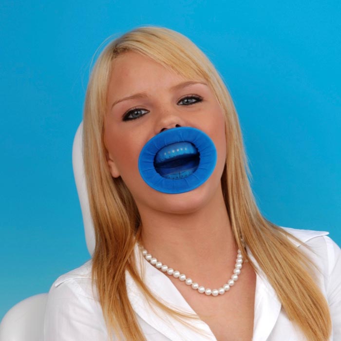 OptraDam eingesetzt bei Patientin zur sicheren Trockenlegung