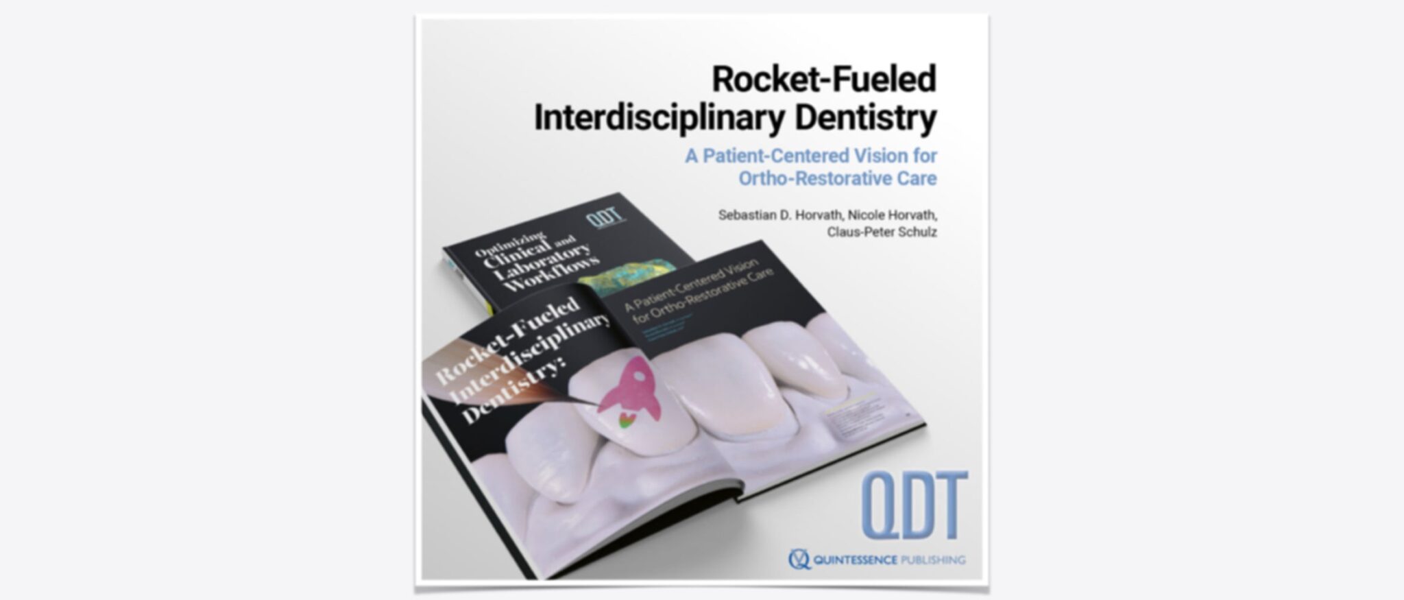 Geöffnete Doppelseite des QDT-Jahrbuchs mit dem wissenschaftlichen Artikel ‚Rocket-Fueled Interdisciplinary Dentistry: A Patient-Centered Vision for Ortho-Restorative Care‘. Das Bild zeigt das professionelle Layout mit klinischen Fallbeispielen zur kombiniert kieferorthopädisch-prothetischen Behandlung.