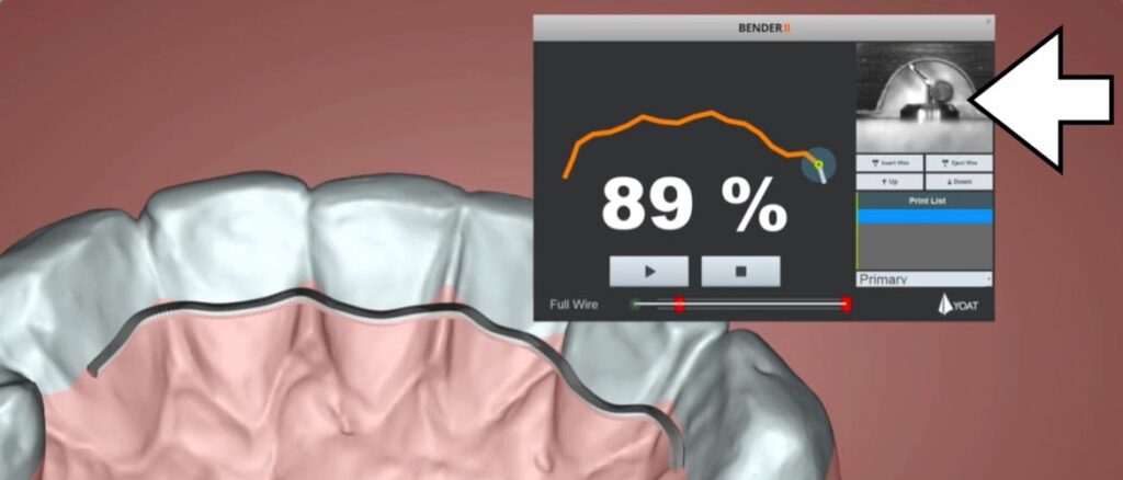 High-Tech in unserer Praxis: Biegeroboter bei der Herstellung eines individuellen Fixed Retainers